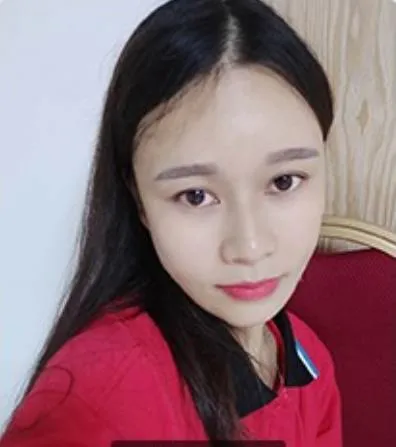幻柔笔记：眼袋修复后气质立现，怎么看都是青春靓丽！