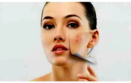 卸妆油会堵塞毛孔吗 正确卸妆保护皮肤