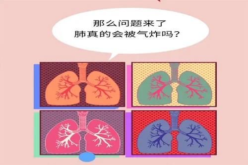 3.webp