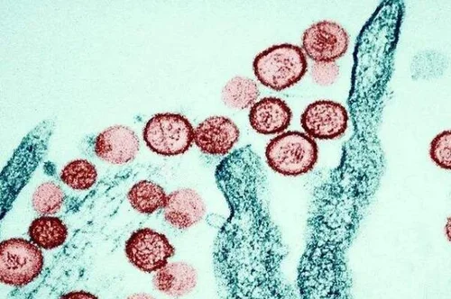 汉坦病毒是什么病_临床表现_流行性出血热简介