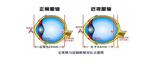 34.webp