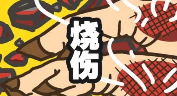 做烧伤疤痕修复禁忌人群及适宜人群有哪些？