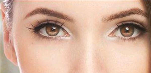 眼角长斑可以用激光去除吗