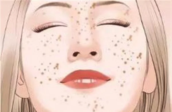 做微晶磨削去雀斑价格贵不贵