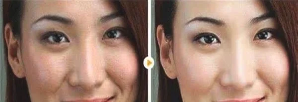 做去色斑治疗效果怎么样？效果保持时间多久？