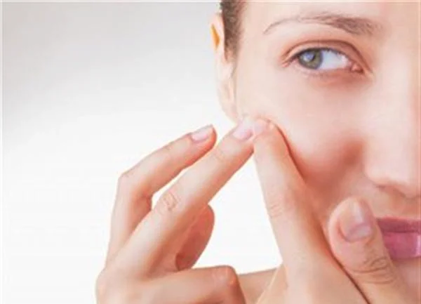 激光祛痘怎么护理?