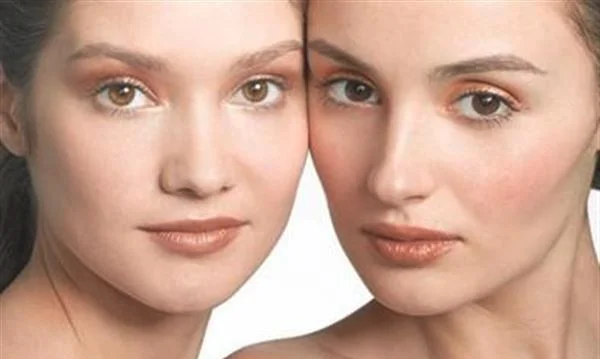 做果酸换肤去眼角细纹多少钱