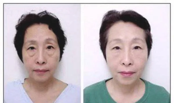 做钻石微雕价格