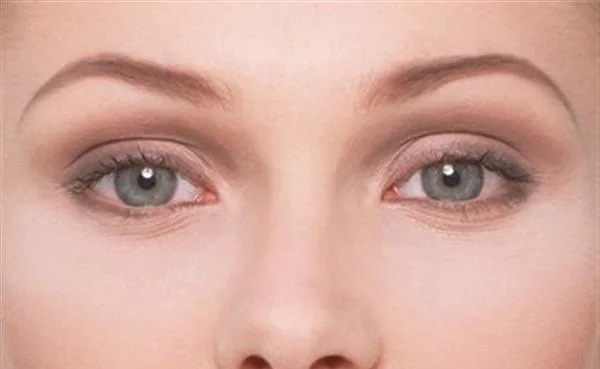 果酸换肤去眼角细纹优点是什么？