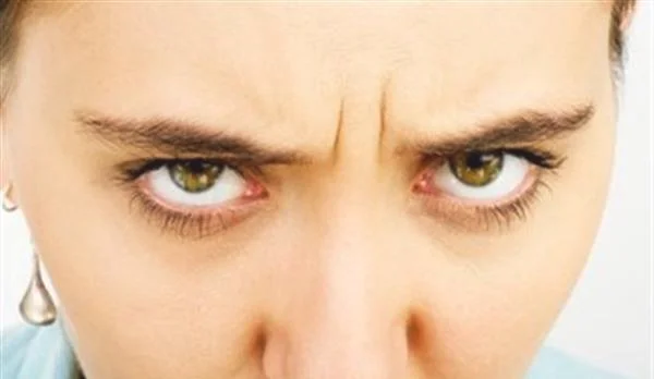 自体脂肪去眉间纹效果怎么样？