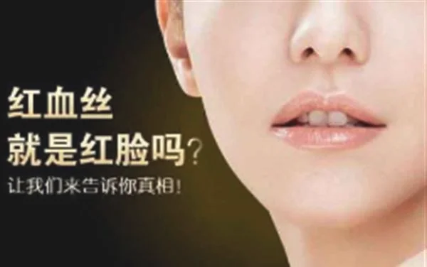 激光去红血丝效果好吗