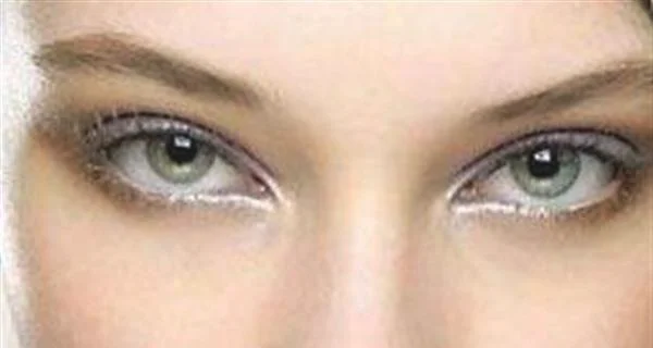 祛抬头纹的妙招
