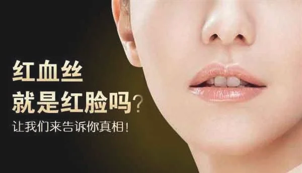 脸上红血丝怎么治疗