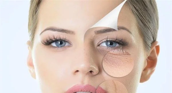 光子去法令纹有什么注意事项?