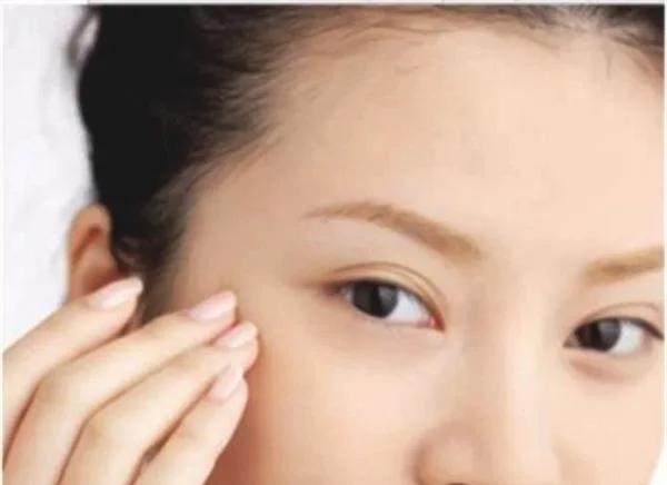 做爱贝芙去眼角细纹费用要多少