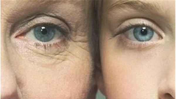 做玻尿酸去眼角细纹价格