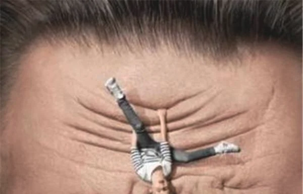 做E光除抬头纹价格