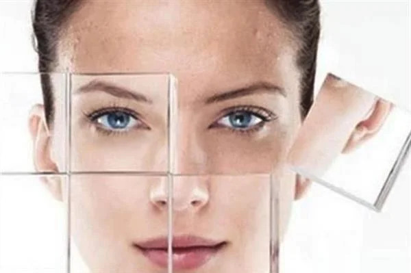 做镭射净肤费用大概需要多少