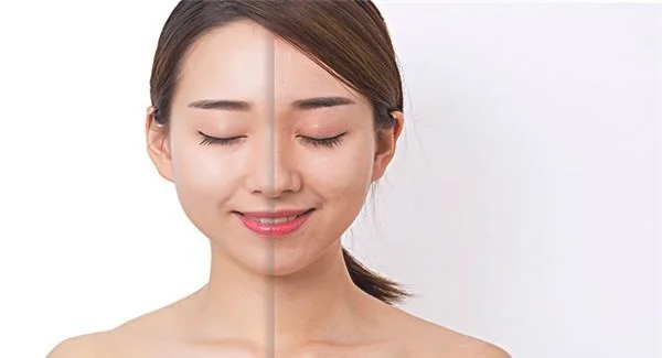 红蓝光美肤需要怎么护理？