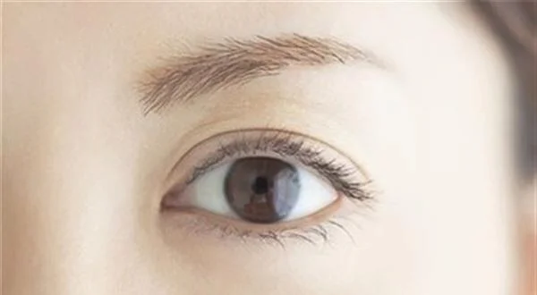 微晶磨皮去眼角细纹优点是什么？
