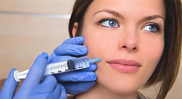 做光子去法令纹费用