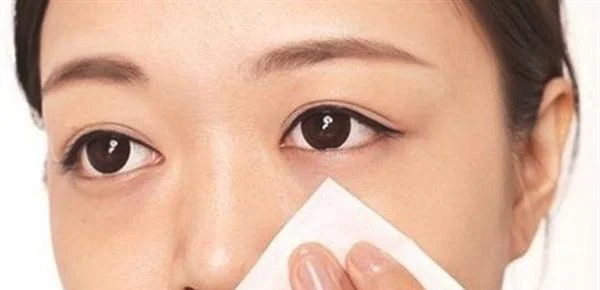 做去粉刺手术多少钱?