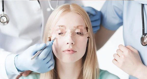 激光去黄褐斑费用