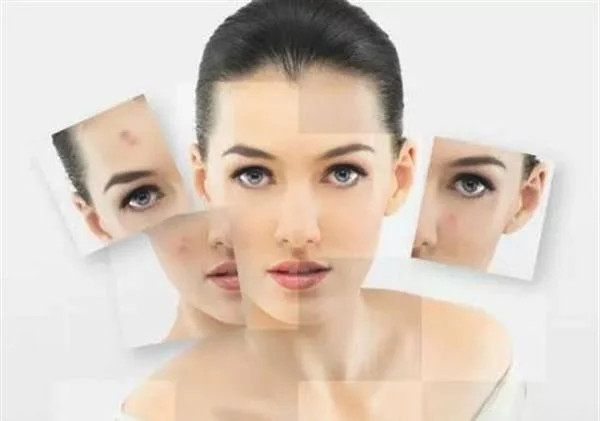 黑色痘印怎么祛除