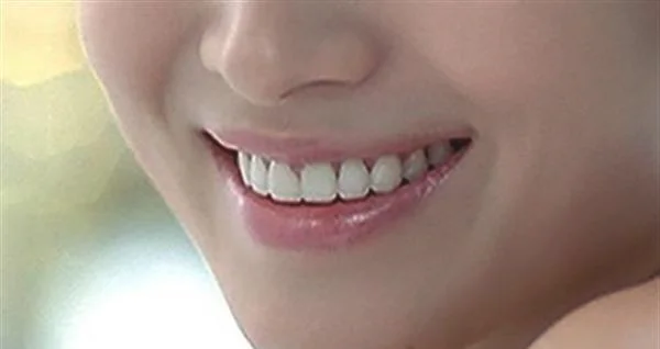 怎样有效的去黑头?