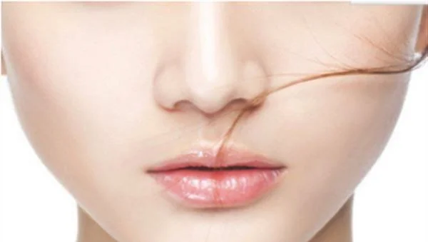 点阵激光去除痘印痘疤怎么样