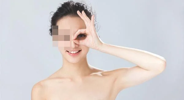 激光除鱼尾纹价格