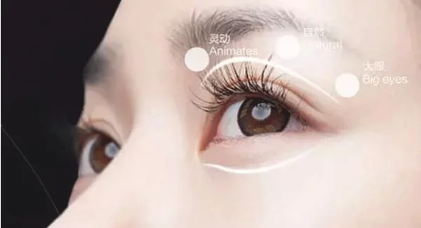 治疗疤痕增生大概多少钱