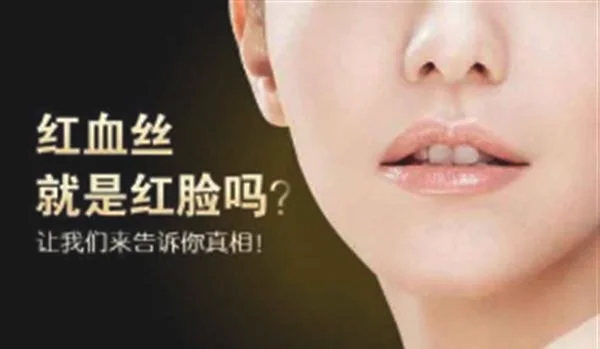 红血丝图片大全
