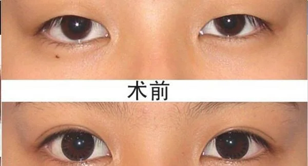 做嫩肤好吗