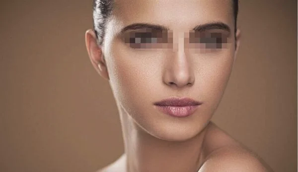 微晶削磨祛斑费用多少