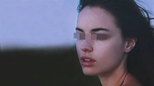 脸上的妊娠斑如何消除