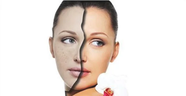 祛疤有哪些方法