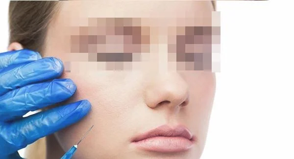 微晶磨皮去鱼尾纹多少钱？