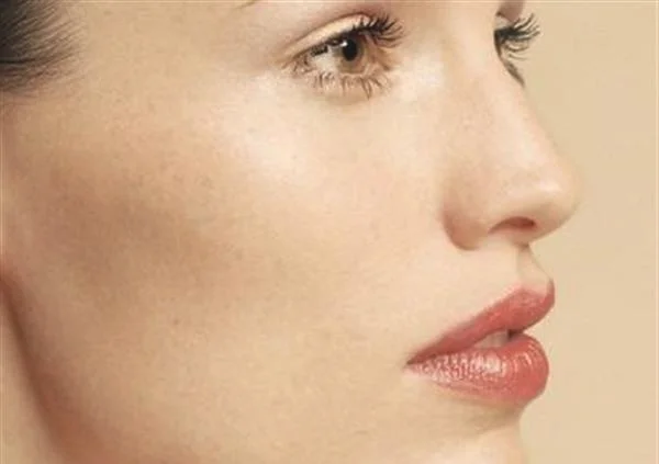 疤痕凹凸修复怎么样