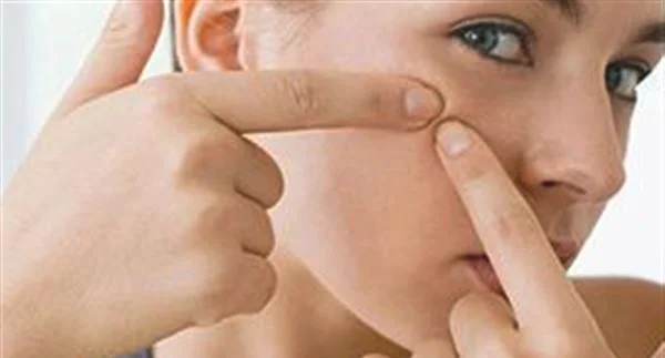 上海青春痘医院哪里比较好