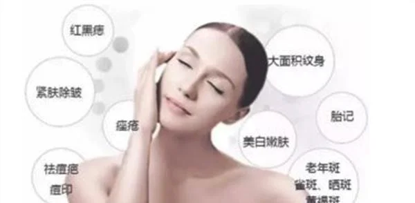 激光祛斑效果好不好