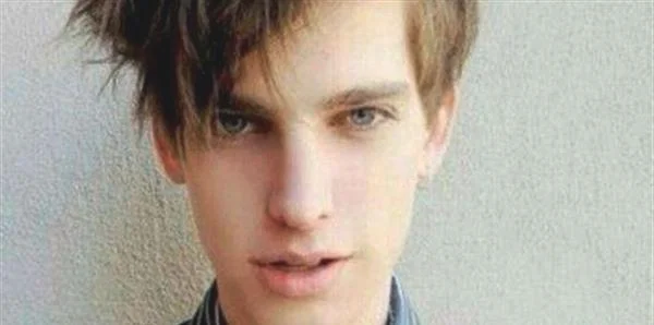 男人脸上黄褐斑怎么办