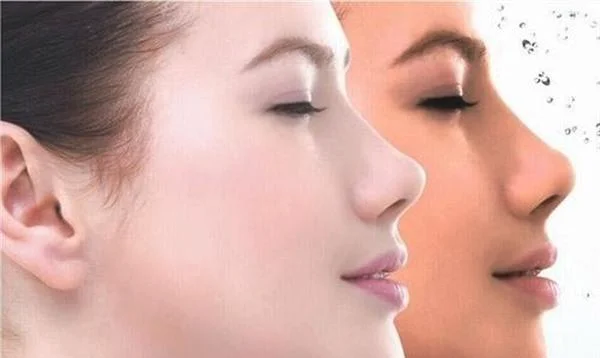 重庆黑脸娃娃整形哪家医院好？