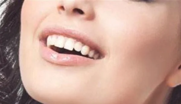 水光娃娃多少钱